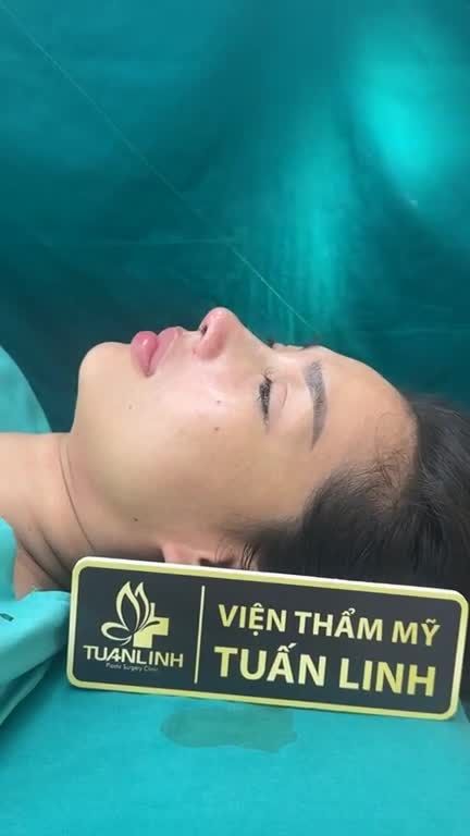 Mũi cấu trúc