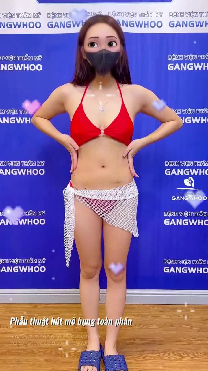 Quá ưng với chiếc vòng 2 sau 1 tuần giảm mỡ bụng tại Gangwhoo