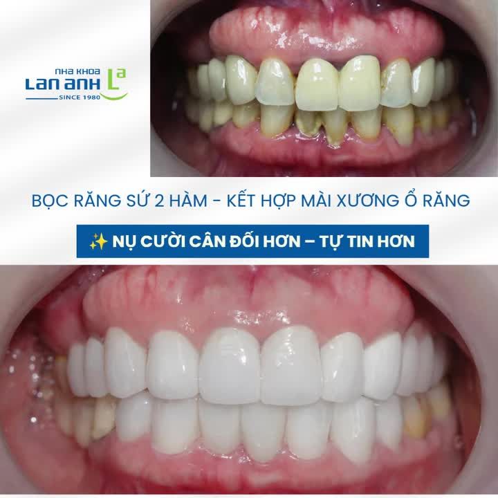 Tuổi tác là điều không thể thay đổi. Nhưng nụ cười thì có.