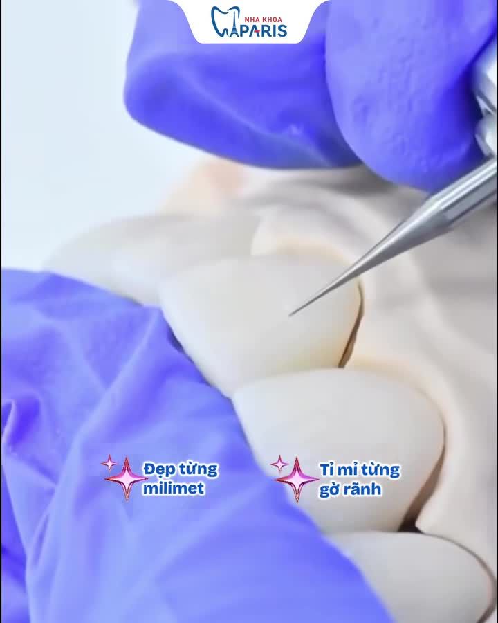 RĂNG SỨ THẨM MỸ – ĐẸP TỪNG MILIMET, TINH TẾ TỪNG ĐƯỜNG NÉT