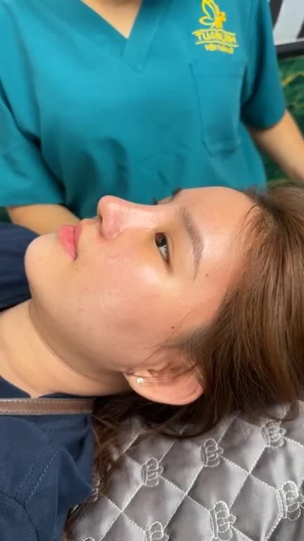 Mũi cấu trúc sửa lại