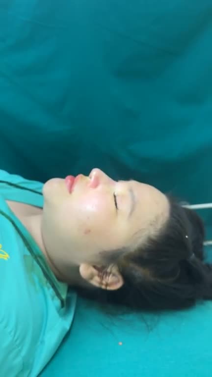 NÂNG MŨI CẤU TRÚC SỬA LẠI – "LẦN THỨ 2" ĐỂ CHẠM ĐẾN VẺ ĐẸP HOÀN HẢO