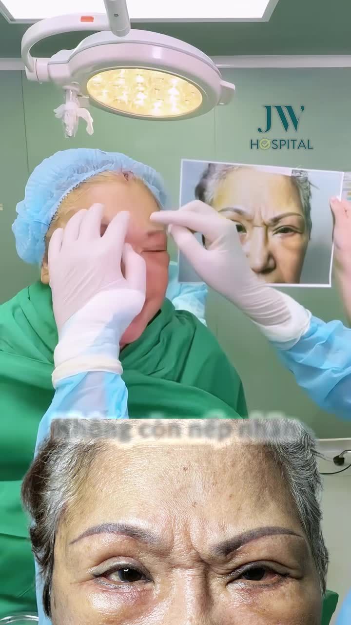 BÁC SĨ TÚ DUNG TUNG TUYỆT CHIÊU C.Ắ.T CƠ CAU MÀY GIÚP U80 VIỆT KIỀU MỸ XÓA SẠCH NẾP NHĂN