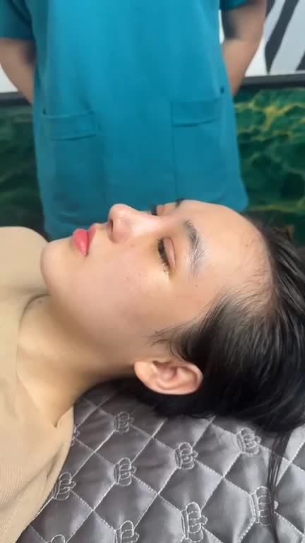 Mũi cấu trúc sau 10 ngày