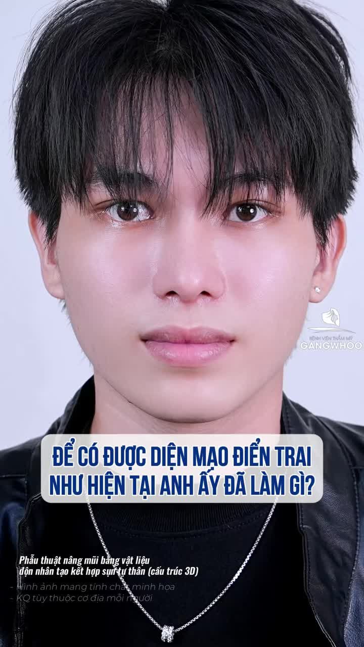 Để có được diện mạo điển trai này, anh ấy đã làm gì