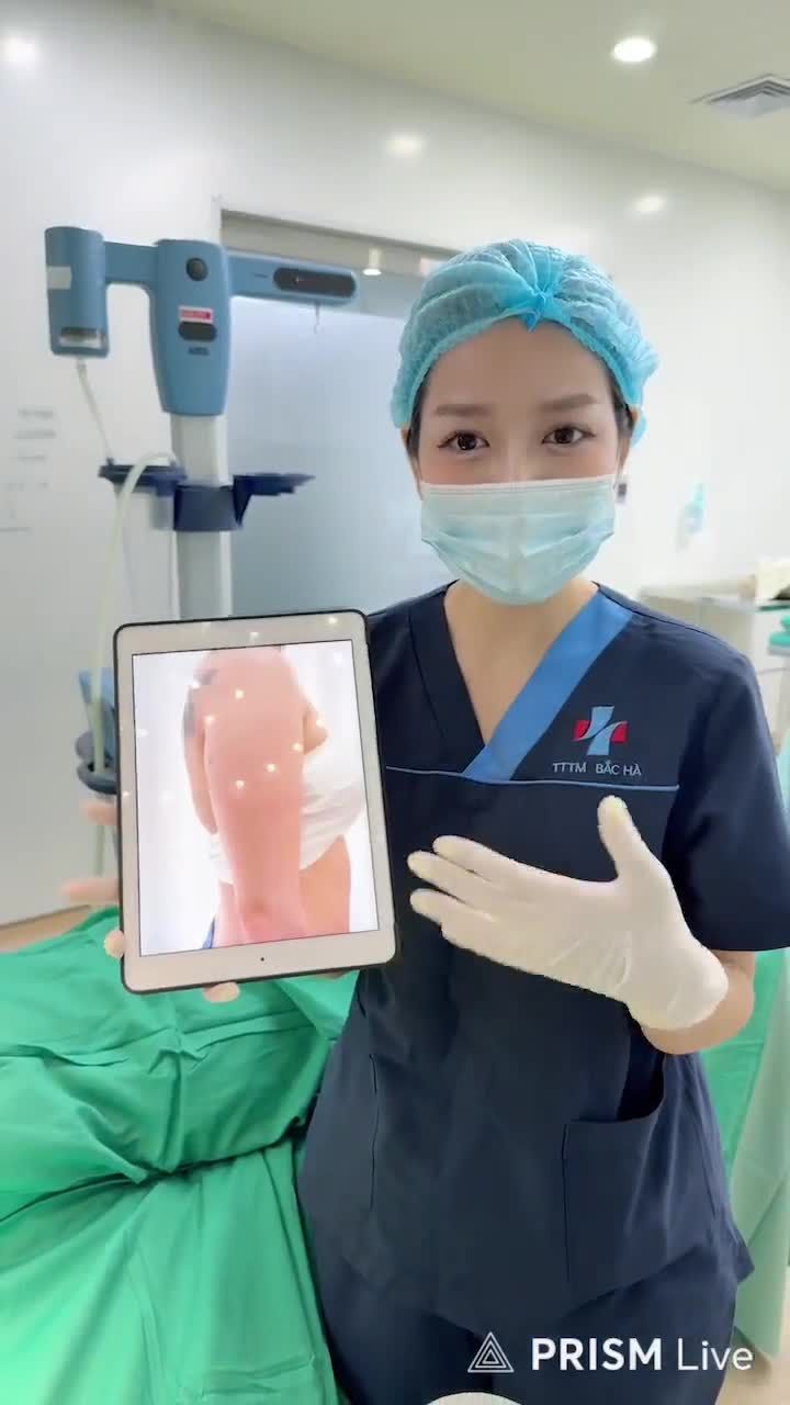 KẾT QUẢ HÚT MỠ CÁNH TAY THỰC TẾ TẠI KHOA THẨM MỸ BẮC HÀ