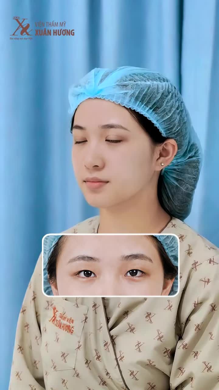 NHẤN MÍ ĐẸP NGAY SAU 20 PHÚT ƯU ĐÃI NHẤN MÍ CHỈ TỪ 4,5 TRIỆU