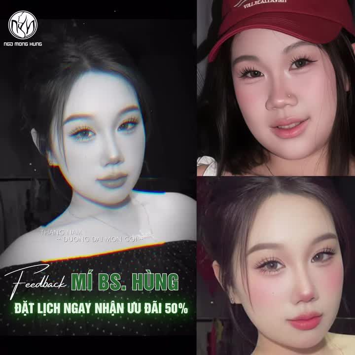 Form mí sau 1 tháng của KH Bệnh viện PTTM Ngô Mộng Hùng!