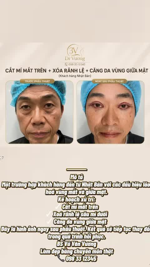 Chuẩn làm đẹp tự nhiên với Dr Vương: Vừa hiệu quả, vừa ko mất nét tự nhiên !
