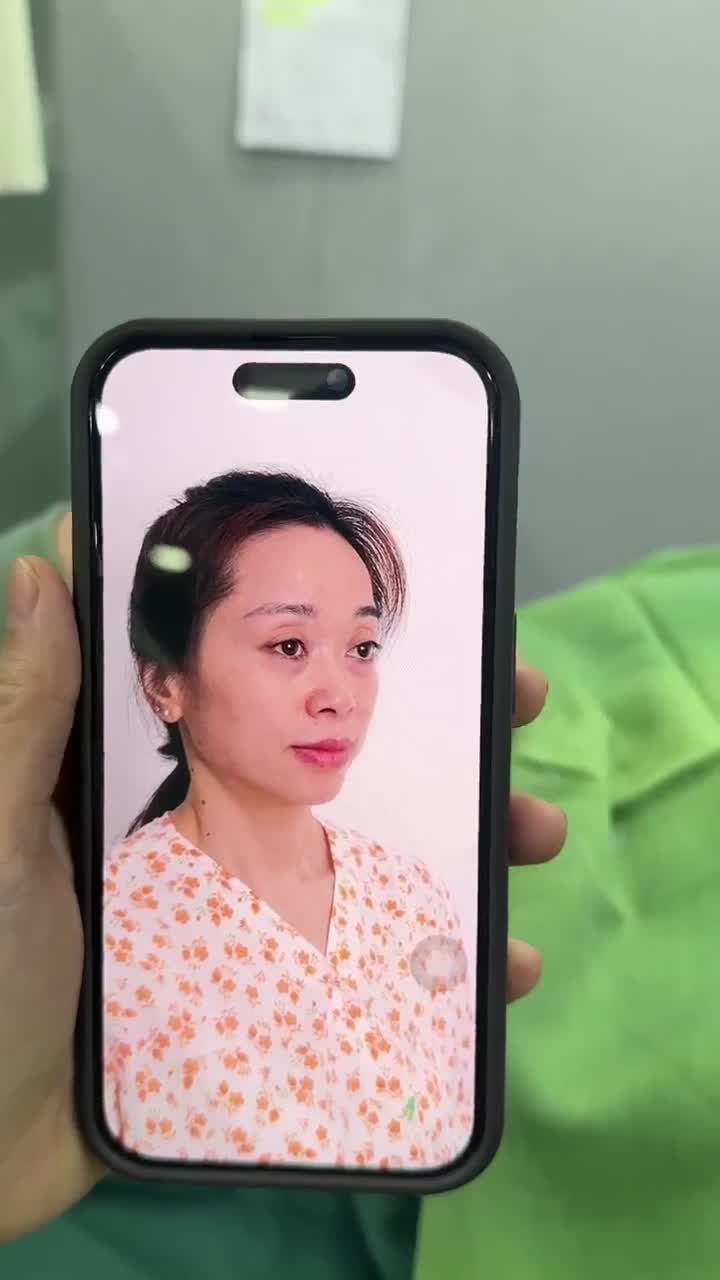 U50 QUYẾT ĐỊNH ĐI NÂNG MŨI VÀ CÁI KẾT...