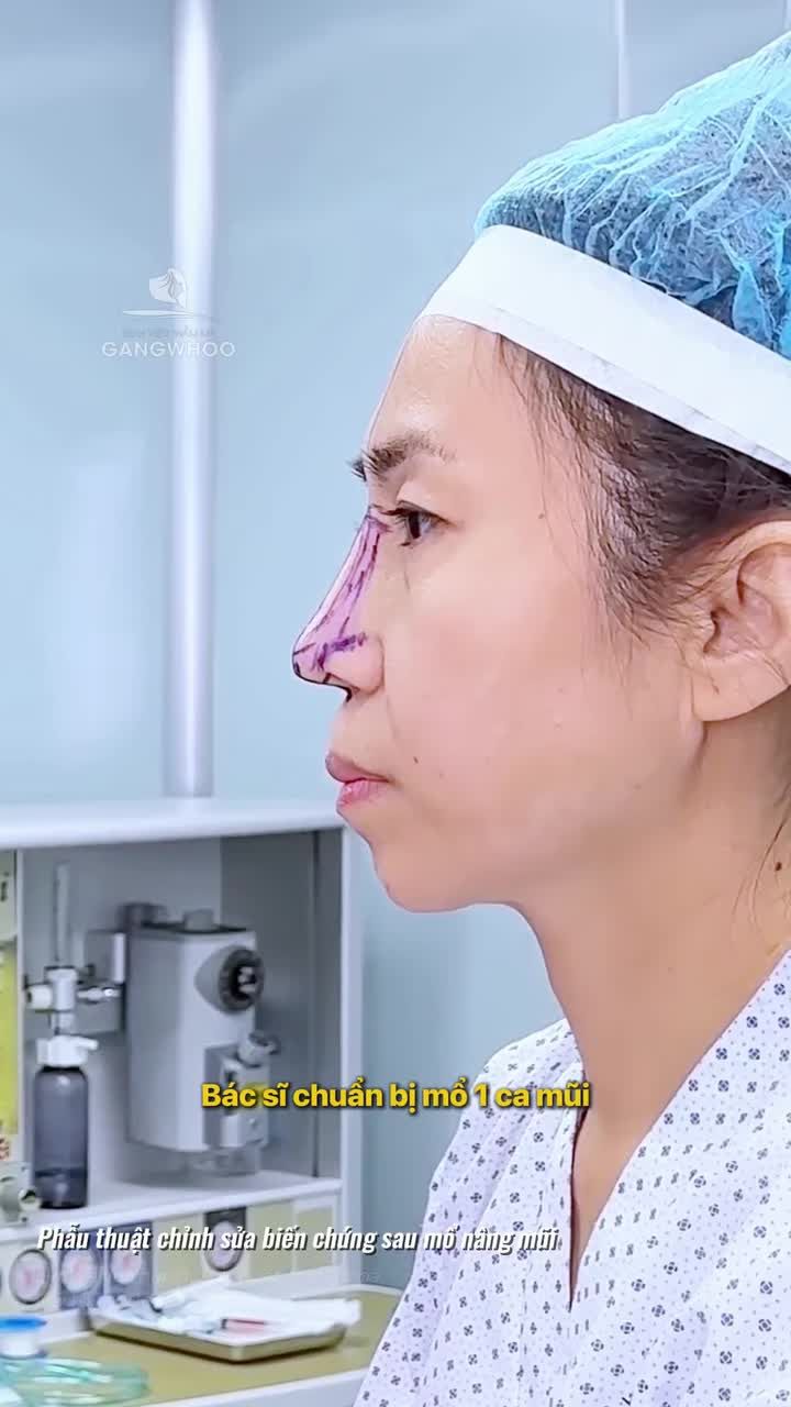Không phải cứ cao là đẹp, dáng mũi đẹp nhất là hài hòa với gương mặt