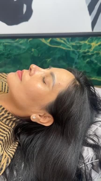 Mũi cấu trúc sau 10 ngày