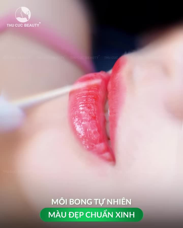 BÍ QUYẾT CỦA MÔI TC: ĐẸP TỨC THÌ – KHÔNG SƯNG – KHÔNG ĐAU