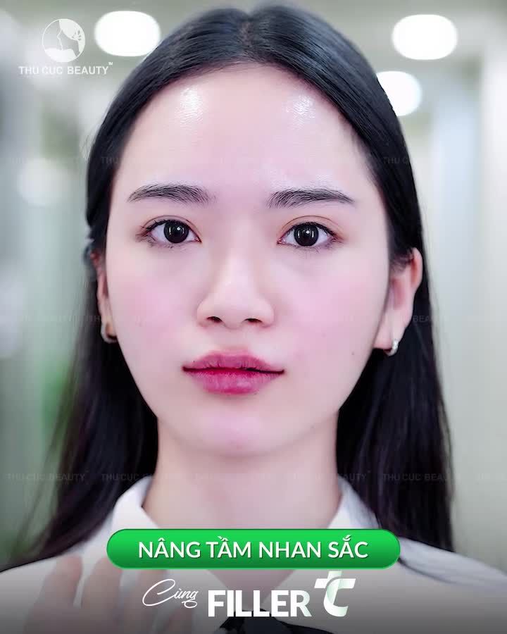ĐÓN HÈ 2026: NÂNG TẦM NHAN SẮC CÙNG FILLER TC