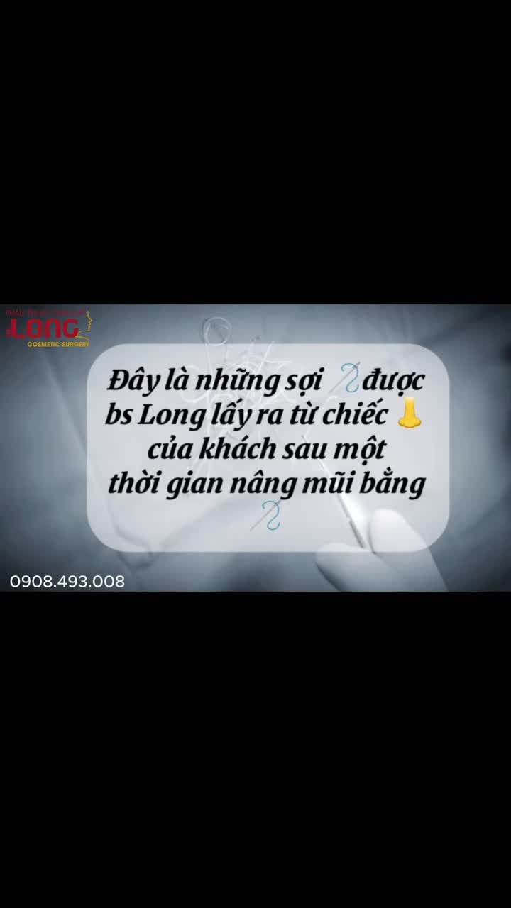 Vén màn sau "nâng mũi = chỉ".
