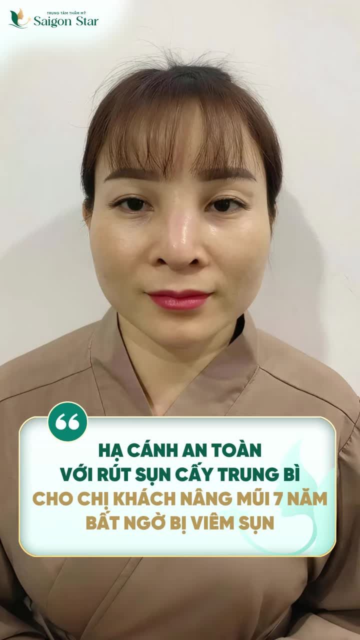 NÂNG MŨI 7 NĂM BẤT NGỜ BỊ BIẾN CHỨNG NẶNG CHỊ KHÁCH ĐƯỢC BÁC SĨ HỌA GIẢI CỨU KỊP THỜI!!!