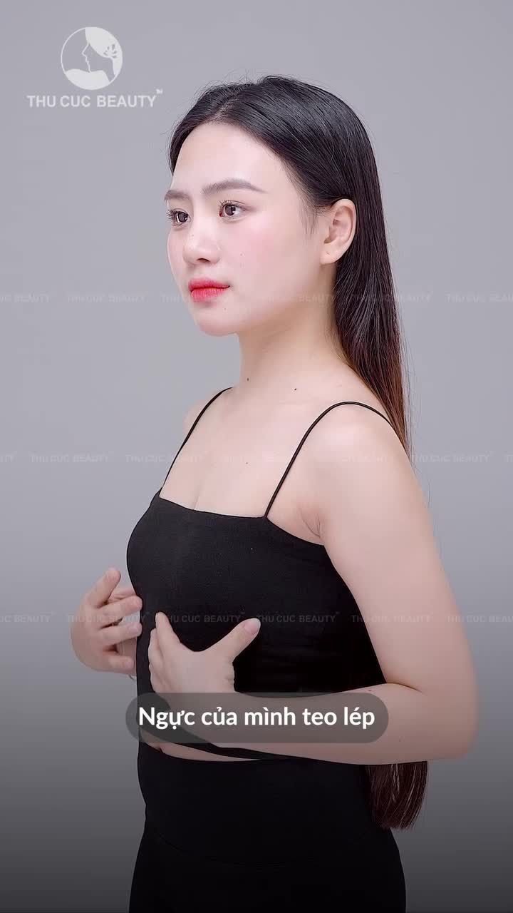 Feedback thật - Sự hài lòng thật sau nâng ngực tại Thu Cúc