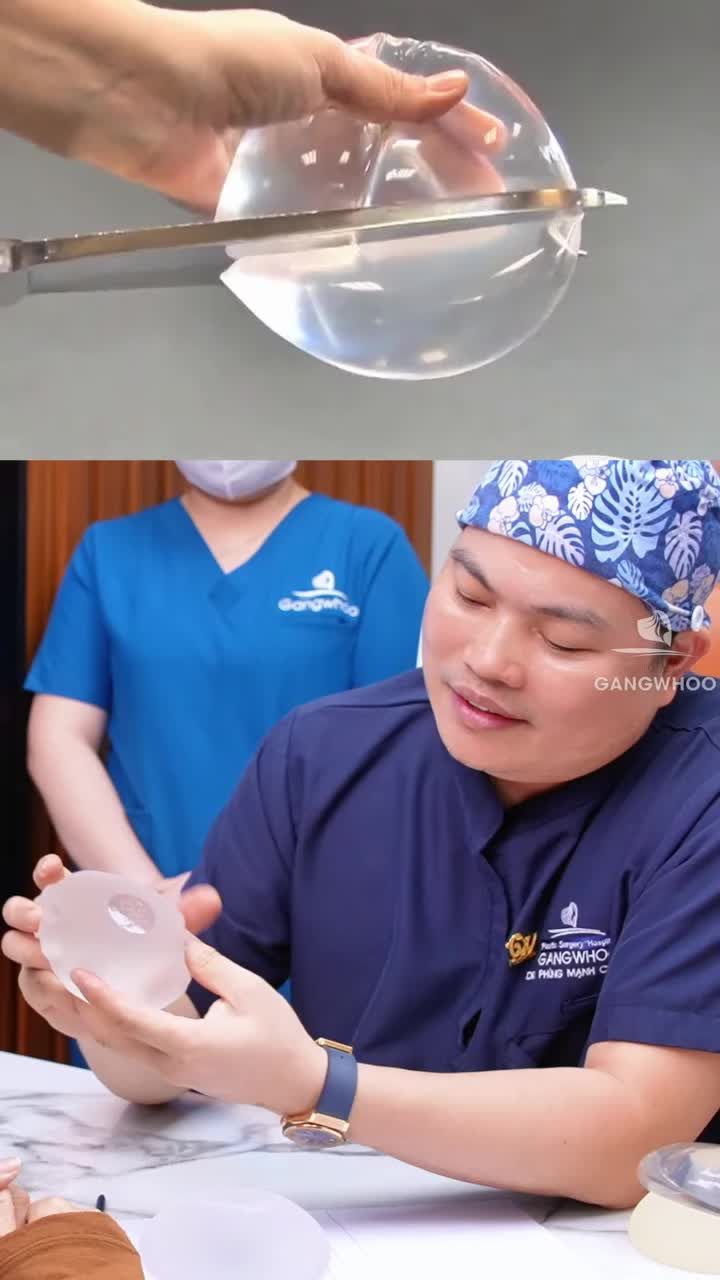 Nâng vòng 1 đặt túi cách đây 10 năm nhưng túi đã bị vỡ liệu có sao không