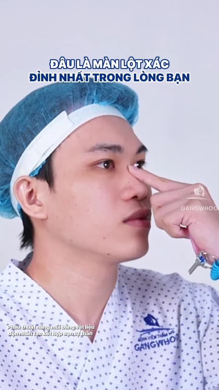 Nam giới hiện đại không ngại nâng mũi. Đâu là màn lột xác đỉnh nhất trong lòng bạn?