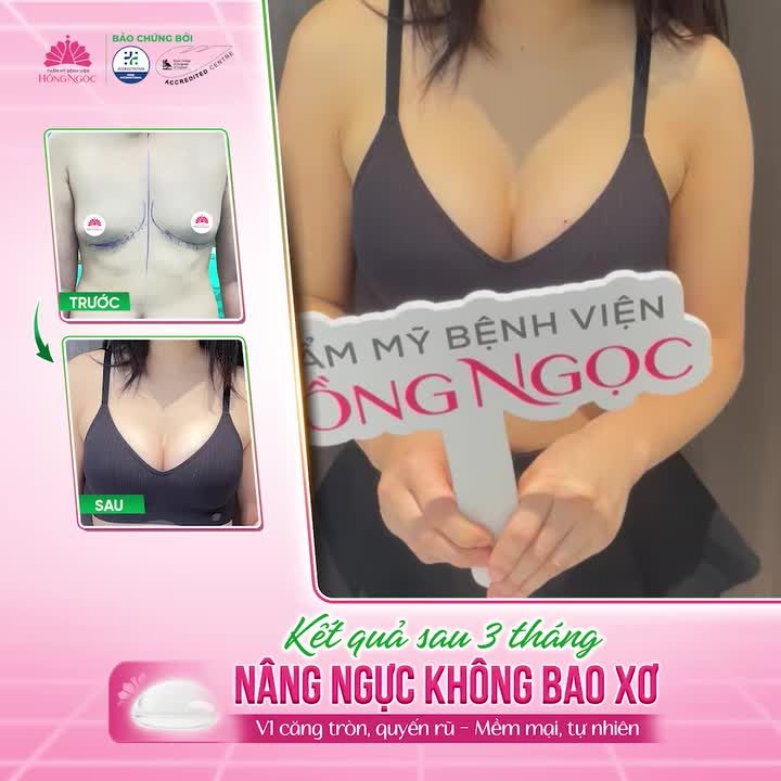 "Trước thì hơi lo lắng, sau thì rất hài lòng"