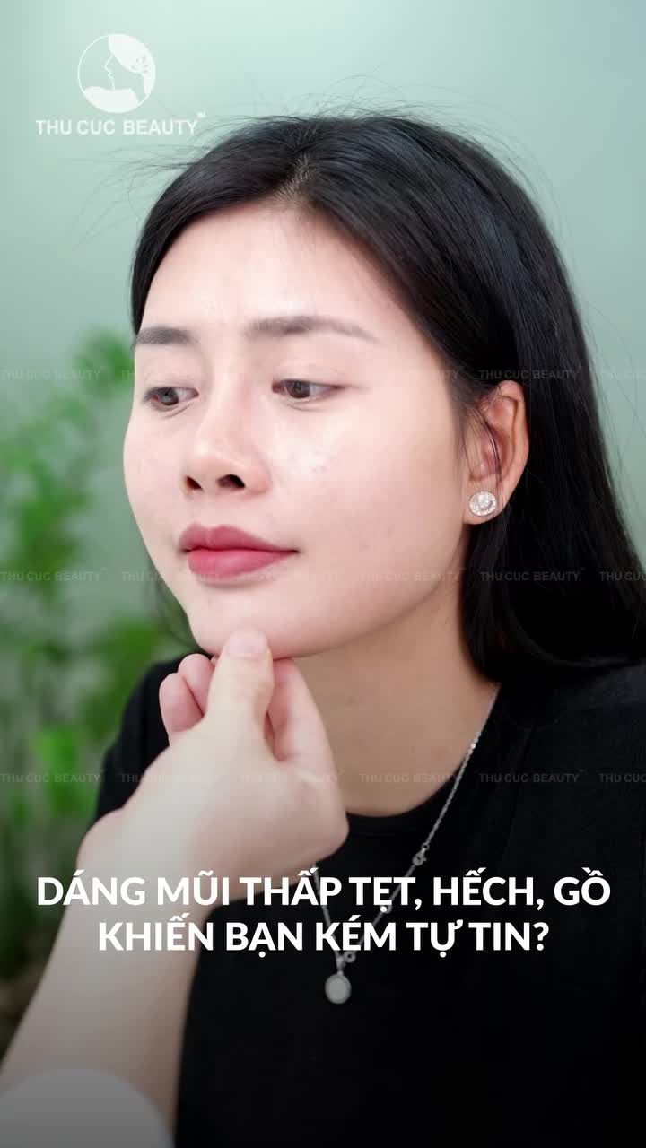 DÁNG MŨI THẤP TẸT, HẾCH, GỒ KHIẾN BẠN KÉM TỰ TIN?