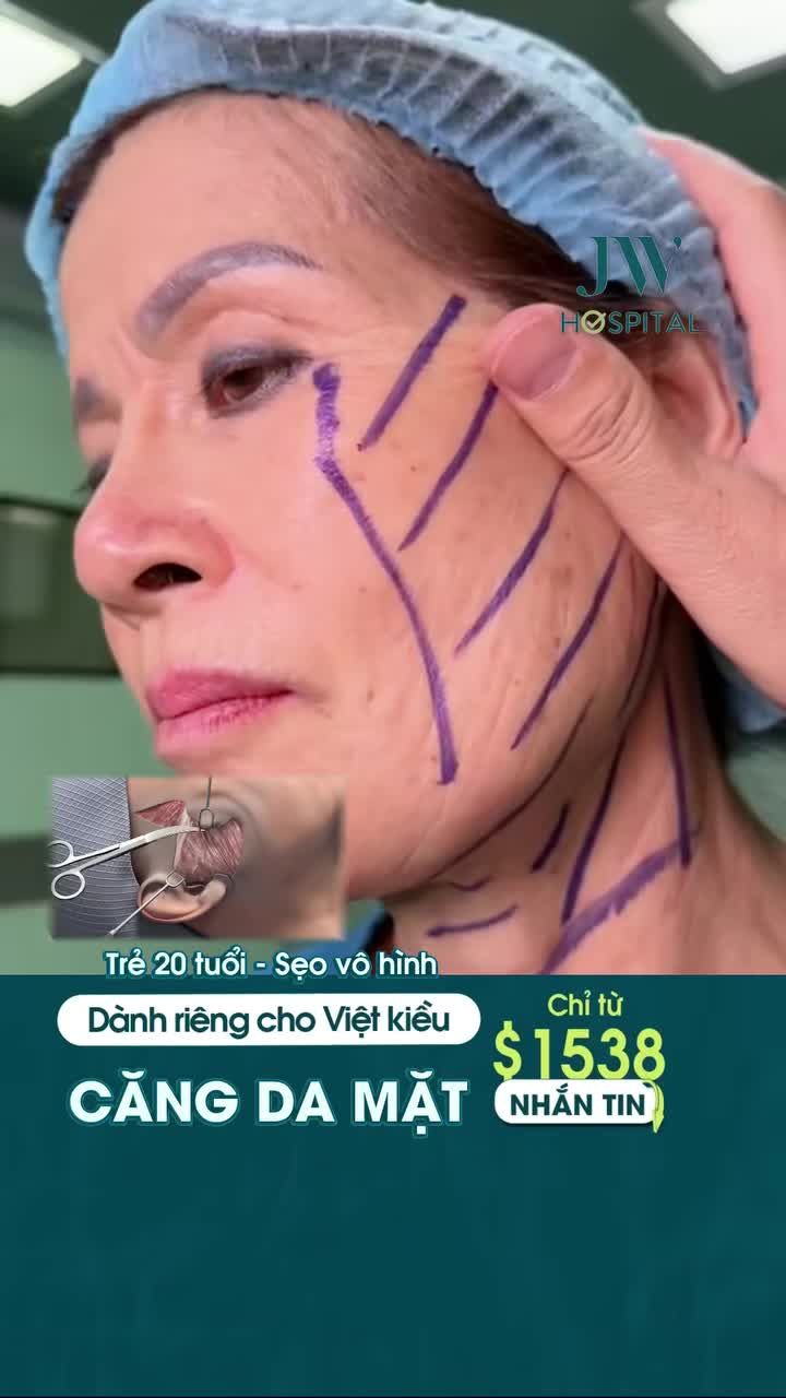 THỰC HƯ BÁC SĨ TÚ DUNG CĂNG DA MẶT SMAS PRO GIÚP U70 VIỆT KIỀU ÚC TRẺ 20 TUỔI, SẸO VÔ HÌNH