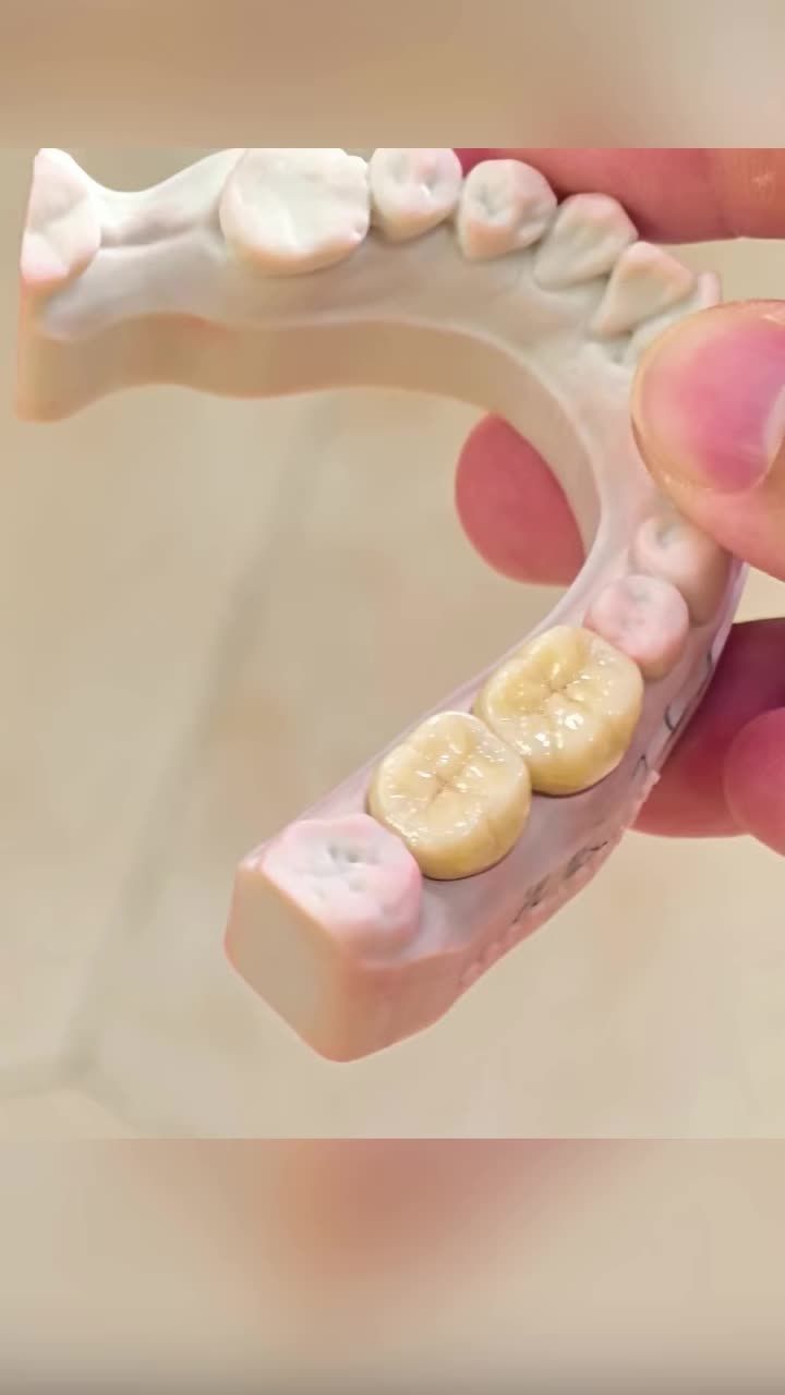 Làm sứ luôn kí phôi chính hãng