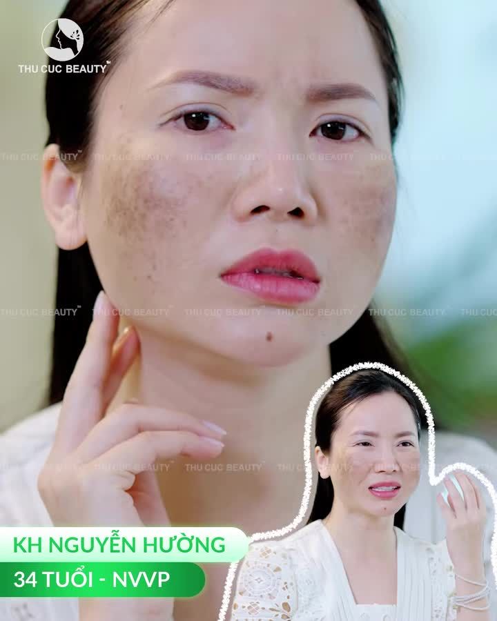 HÀNH TRÌNH TÌM LẠI LÀN DA KHÔNG TUỔI CỦA CÔ NÀNG CÔNG SỞ