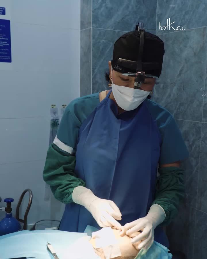 MŨI HẾCH, ĐẦU MŨI NGẮN THÌ NÊN CHỌN PHƯƠNG PHÁP NÀO ĐỂ CẢI THIỆN?