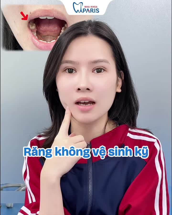 TRỒNG RĂNG IMPLANT CHUẨN PHÁP - ĂN NHAI CHẮC KHỎE, BỀN ĐẸP TRỌN ĐỜI!