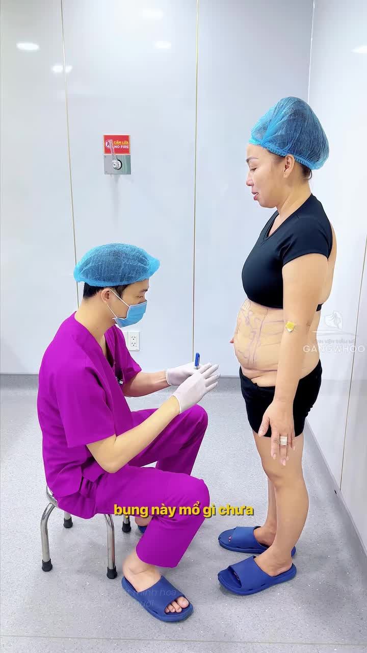 7 tháng sau giảm mỡ chiếc bụng này sẽ ra sao?