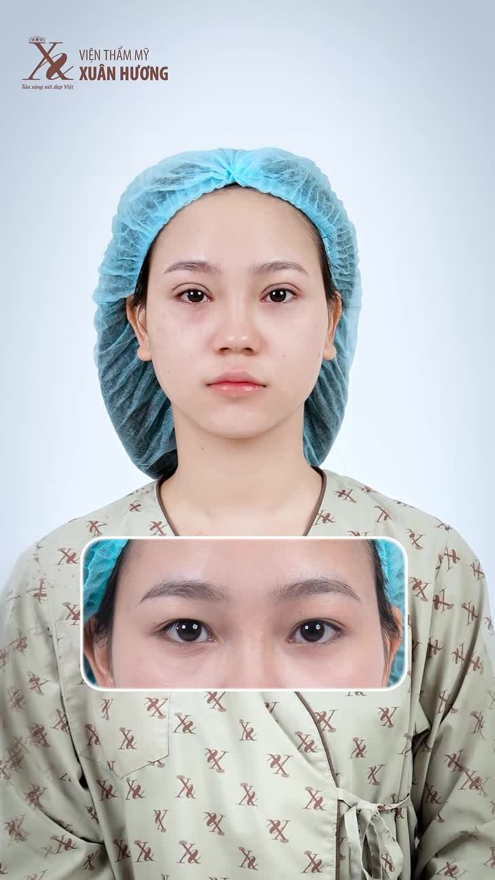 THAY ĐỔI NHỎ GIÚP RẠNG NGỜI THẦN THÁI