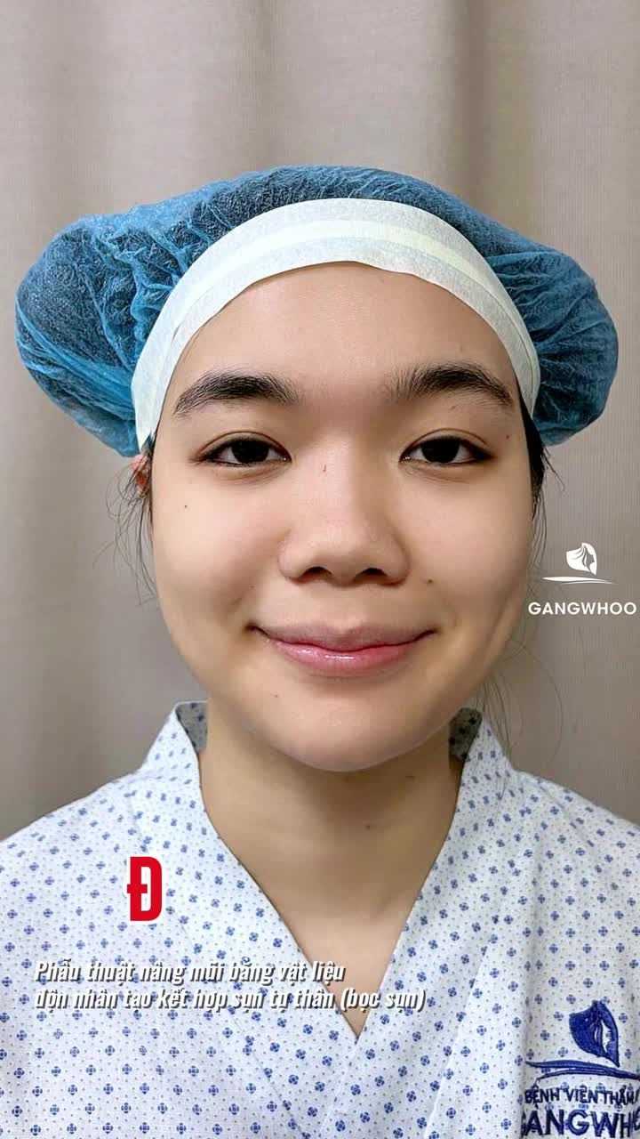 Chiếc mũi ai cũng nghĩ 100TR là đây!