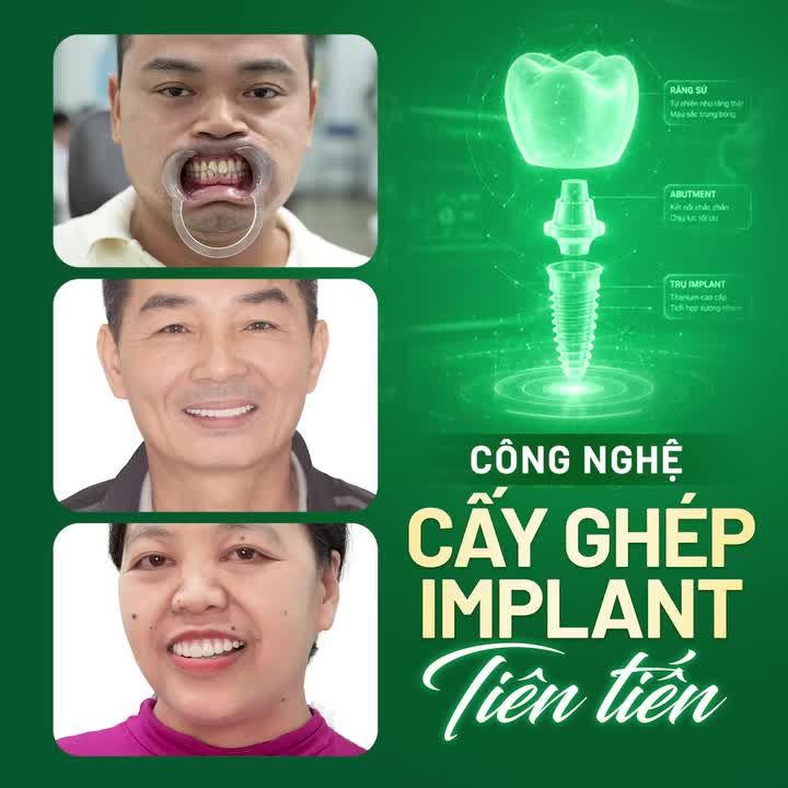 CÔ CHÚ, ANH CHỊ ƠI! MẤT RĂNG XIN ĐỪNG CHẦN CHỪ