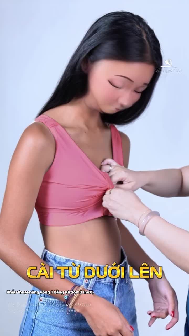 Sau nâng cấp vòng 1, mặc áo định hình như thế nào cho đúng chuẩn