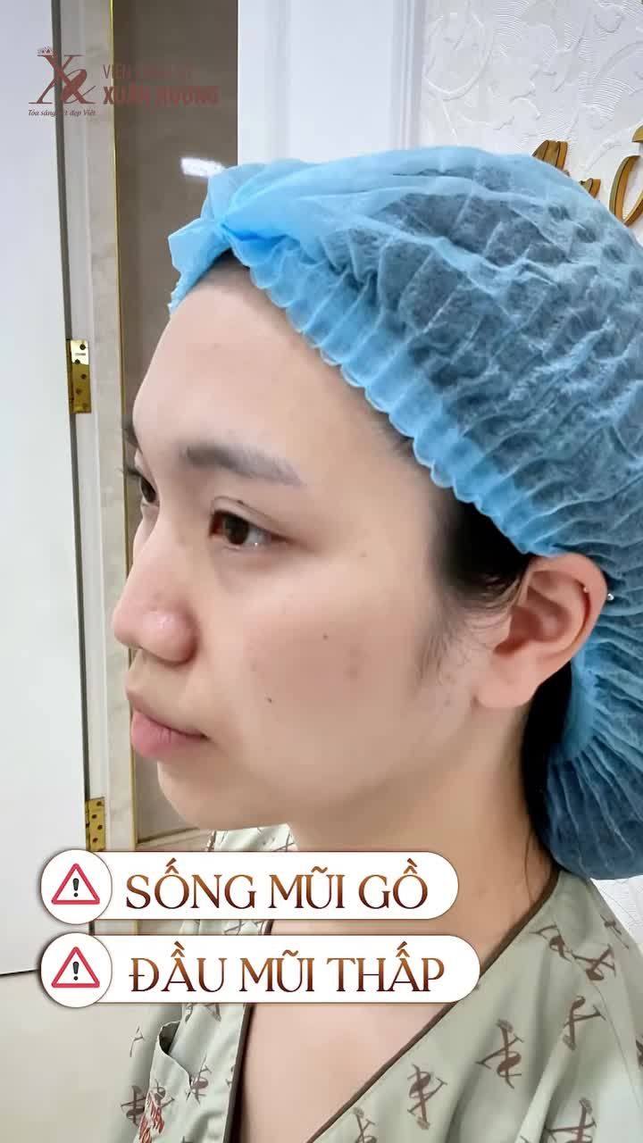 ĐỪNG ĐỂ CHIẾC MŨI THẤP GIẤU ĐI NHAN SẮC CỦA BẠN!