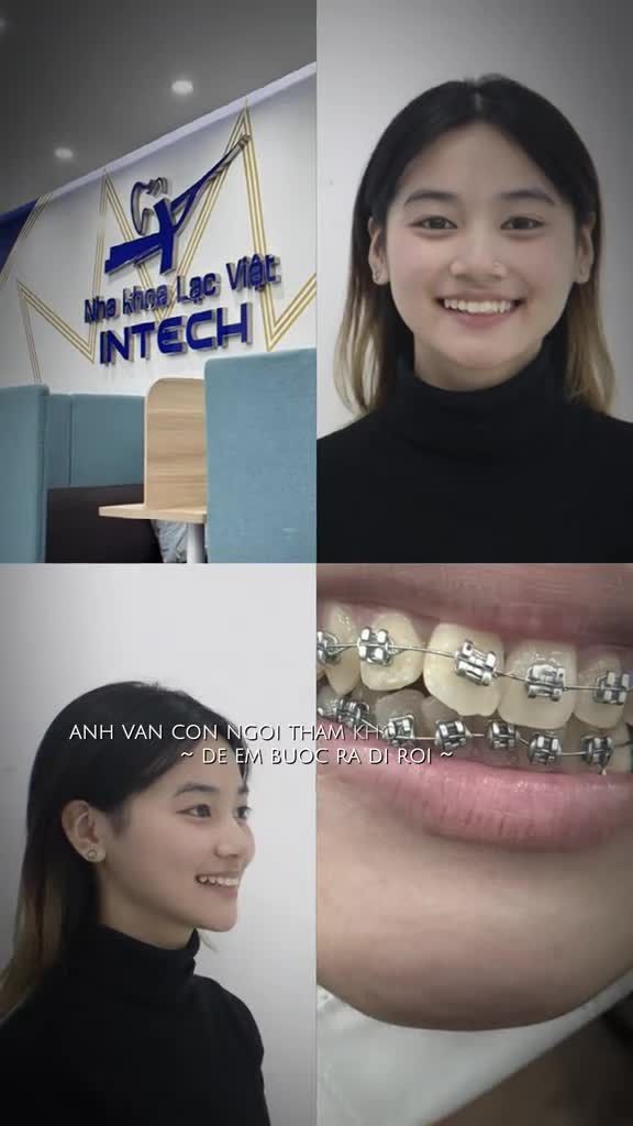 "Sau 2 năm đồng hành với Lạc Việt Intech,  tôi đã đạt đến cảnh giới không muốn tháo niềng "