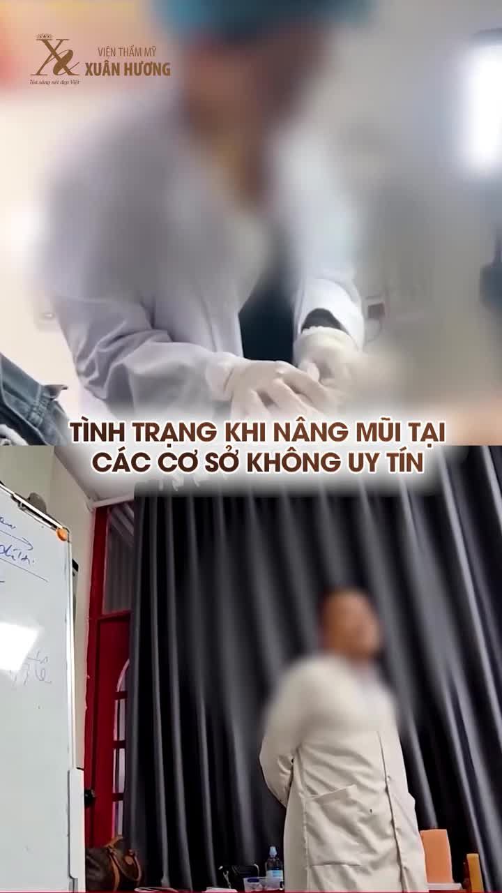 NÂNG MŨI HỎNG, LỆCH , BÓNG ĐỎ ĐẦU MŨI?