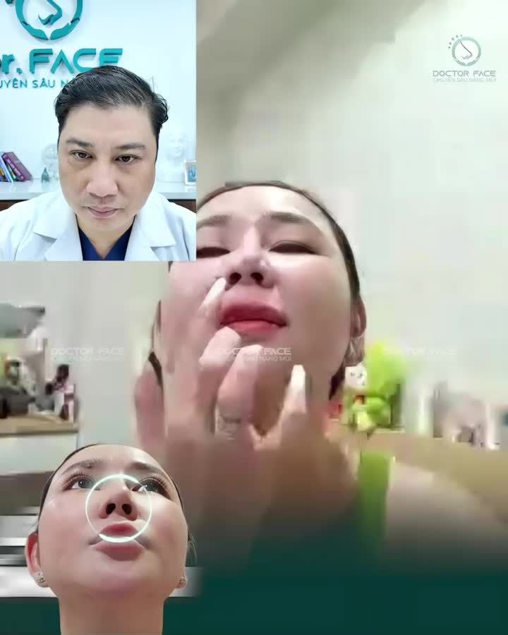 Chỉ qua một cuộc video call, chị khách này đã biết vì sao chiếc m.ũi sau 16 năm lại bị lệch và hếch hơn