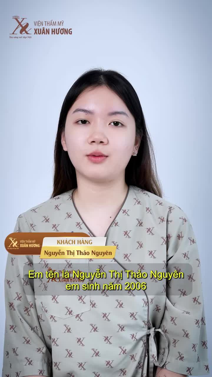 TÔI ĐÃ LÀM GÌ ĐỂ CÓ CHIẾC MŨI ĐẸP THẾ NÀY
