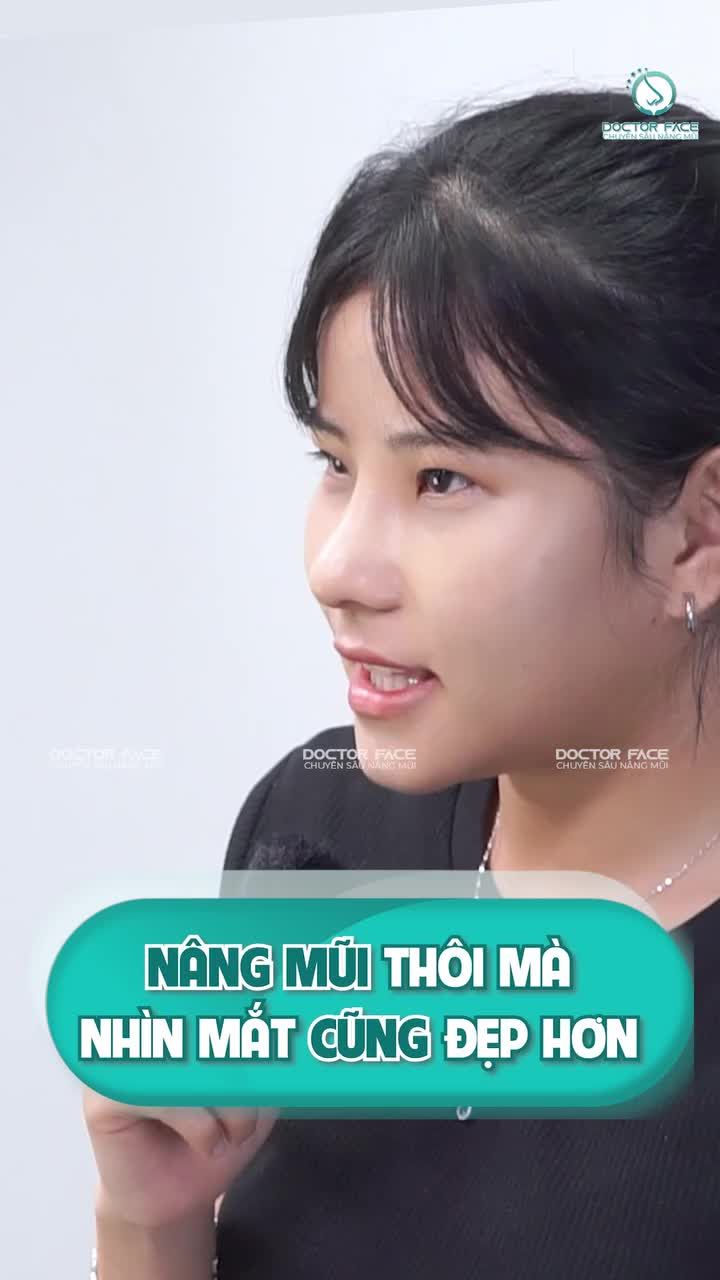 Chỉ thay đổi chiếc mũi thôi mà nhìn góc nghiêng đẹp hơn hẳn, thậm chí đôi mắt cũng khác nữa