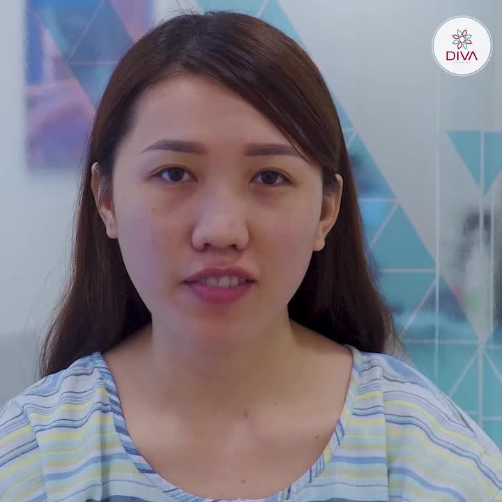 THAY ĐỔI THẦN THÁI KHUÔN MẶT SAU KHI LẤY TÚI MỠ MÍ DƯỚI - CẤY MỠ MẮT DƯỚI VÀ NÂNG MŨI TINYPOINT