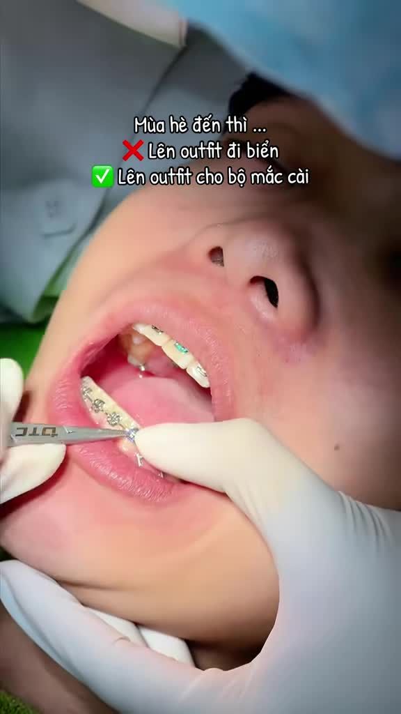 Phụ kiện mùa hè hot hit năm nay, vịu ơ nào đã thử chưa