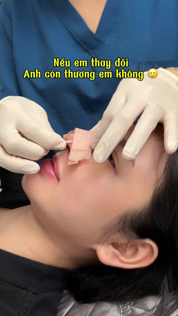 MŨI 10 NGÀY THÁO NẸP – ĐẸP XUẤT SẮC!!