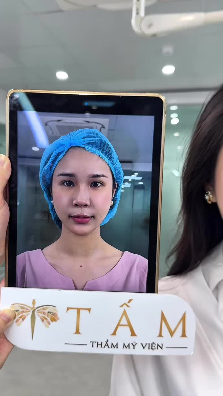 Bí kíp nào đã giúp đôi mắt mệt mỏi, trũng sâu bỗng hóa to tròn, rạng rỡ và "hack" ngay 10 tuổi?