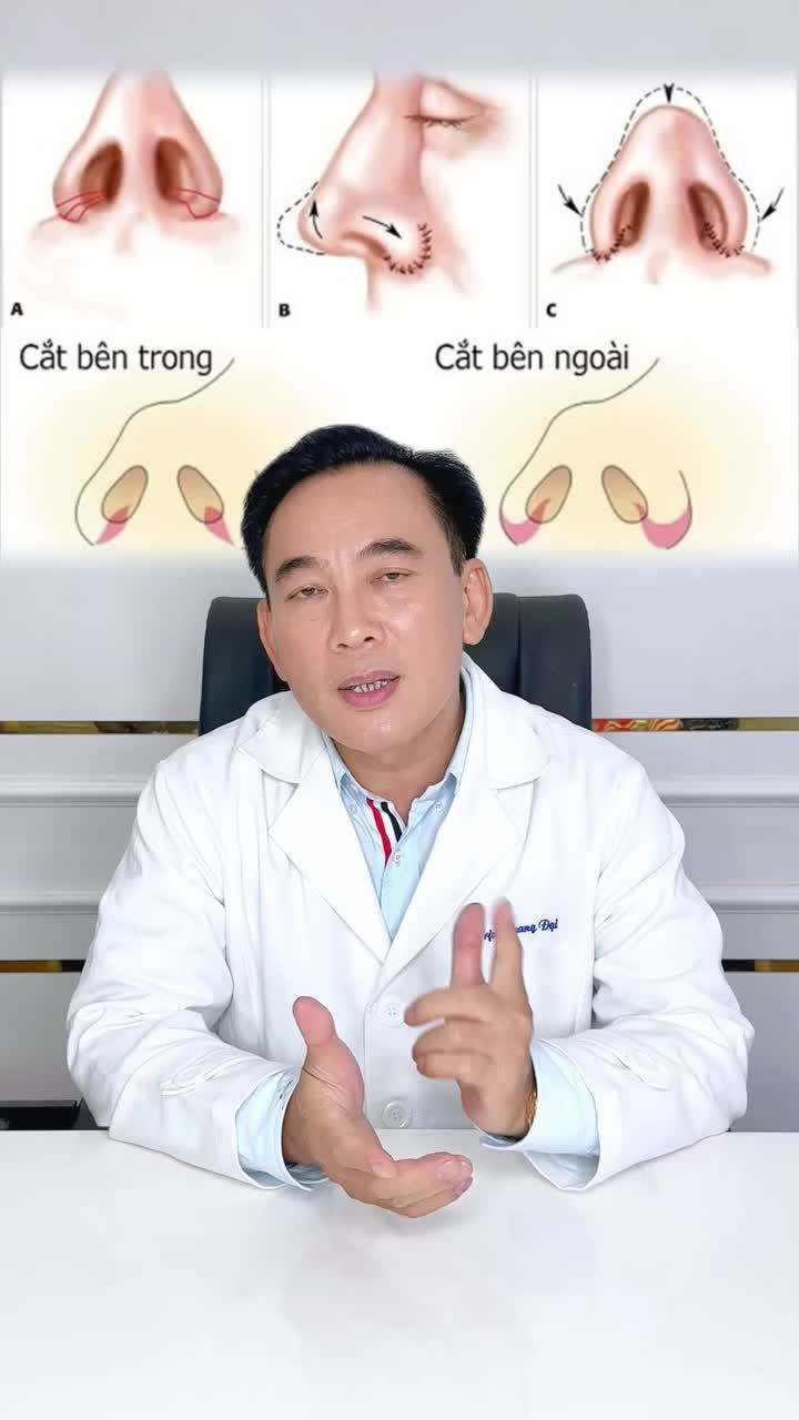 BẬT MÍ  2 PHƯƠNG PHÁP THU GỌN CÁNH MŨI