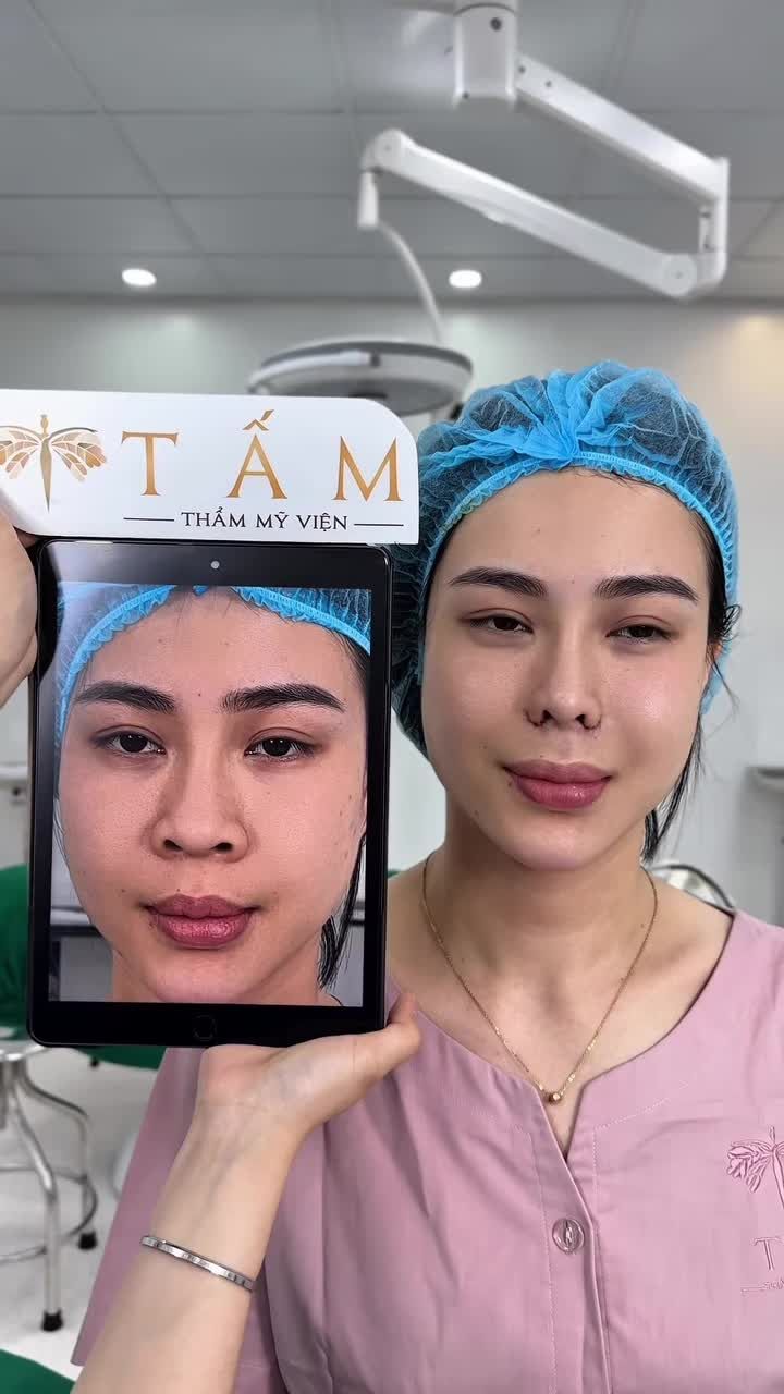 Bạn có tin chiếc mũi thô, bè bẩm sinh có thể hóa thon gọn, thanh tú chỉ trong tích tắc?