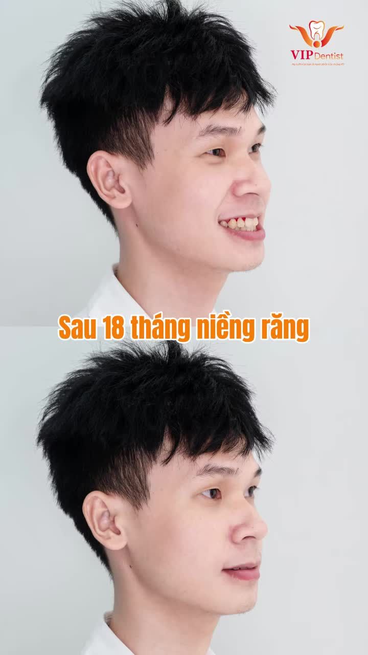 18 tháng cho 1 nụ cười tỏa sáng!