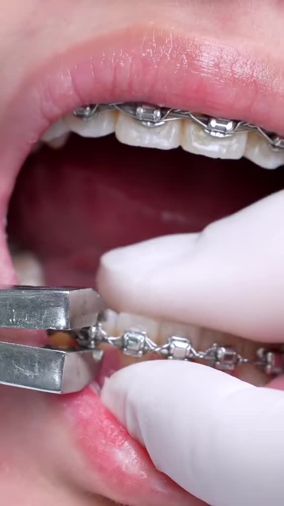 HÀNH TRÌNH 2 NĂM GÓI GỌN TRONG 30 GIÂY THÁO NIỀNG!
