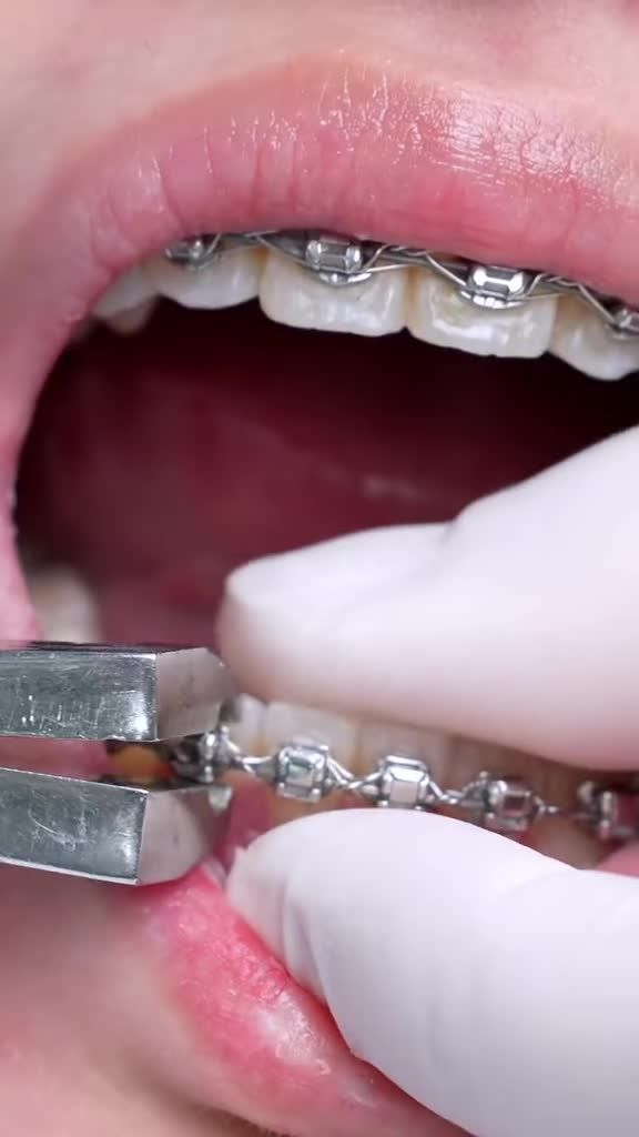 HÀNH TRÌNH 2 NĂM GÓI GỌN TRONG 30 GIÂY THÁO NIỀNG!